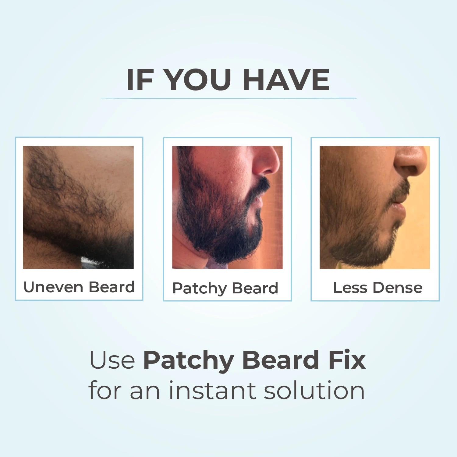 Patchy Beard Fix