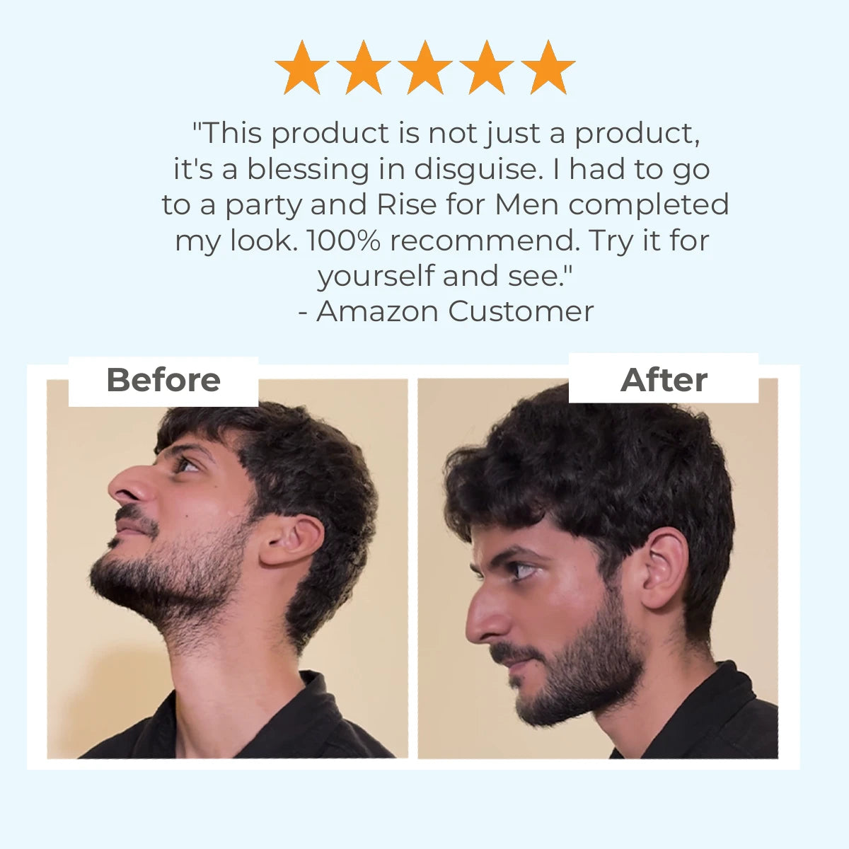 Patchy Beard Fix