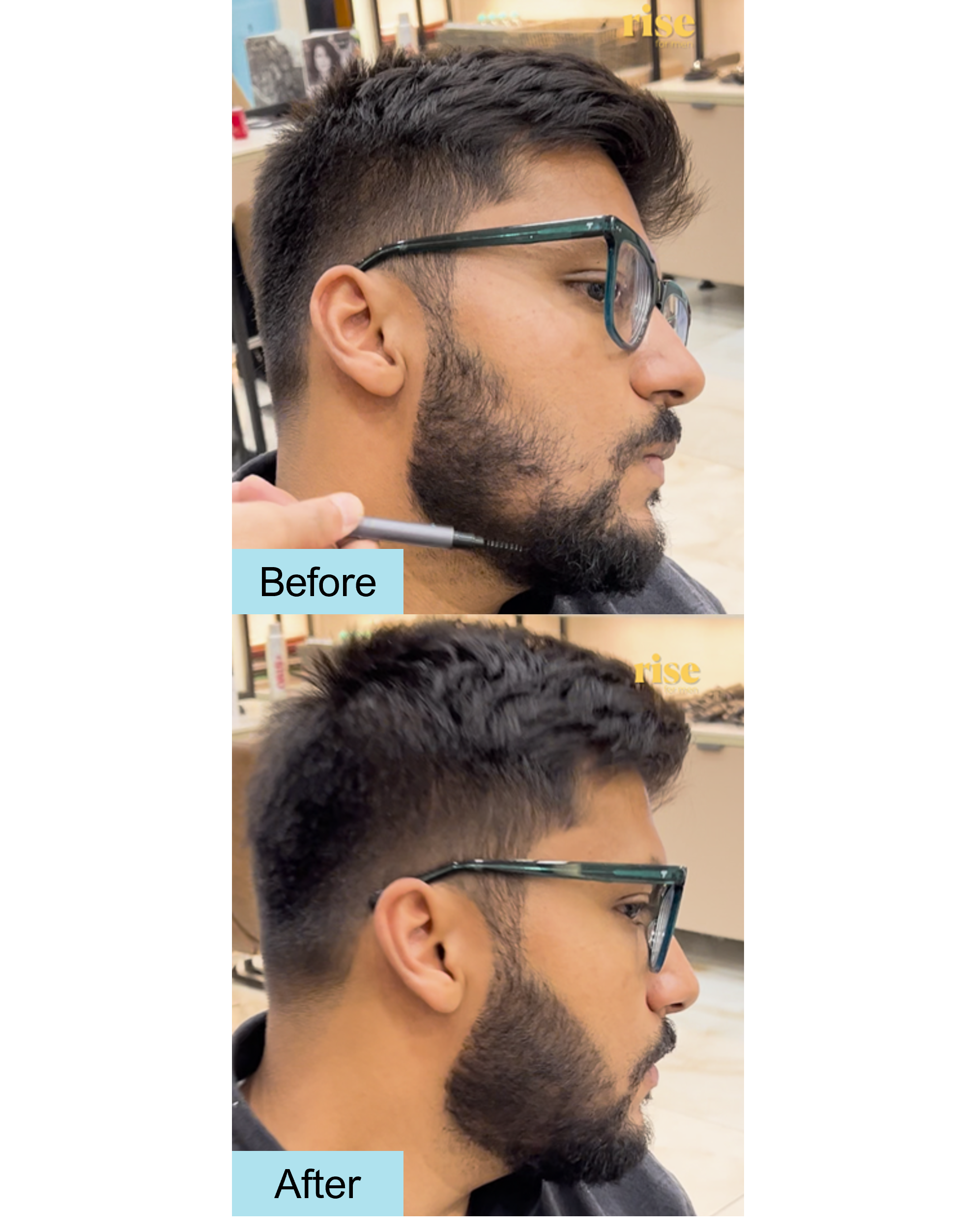 Patchy Beard Fix