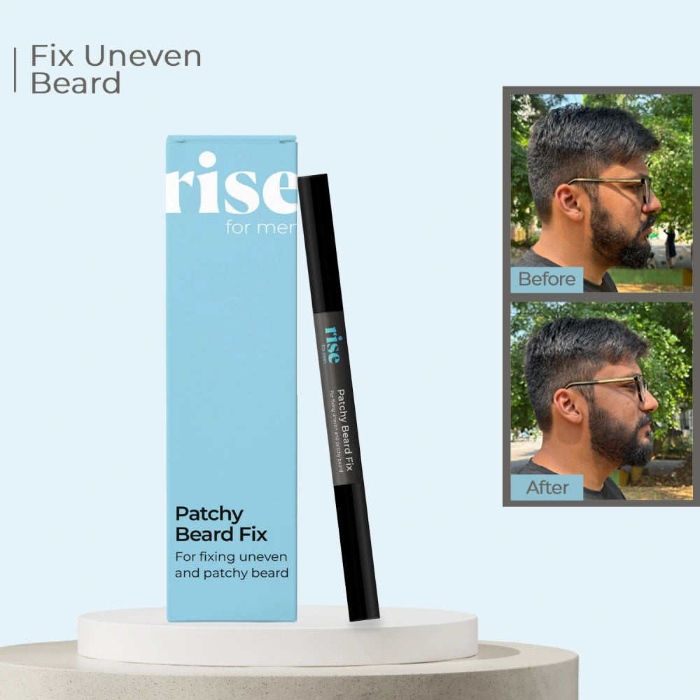 Patchy Beard Fix
