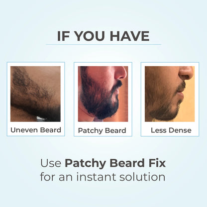 Patchy Beard Fix
