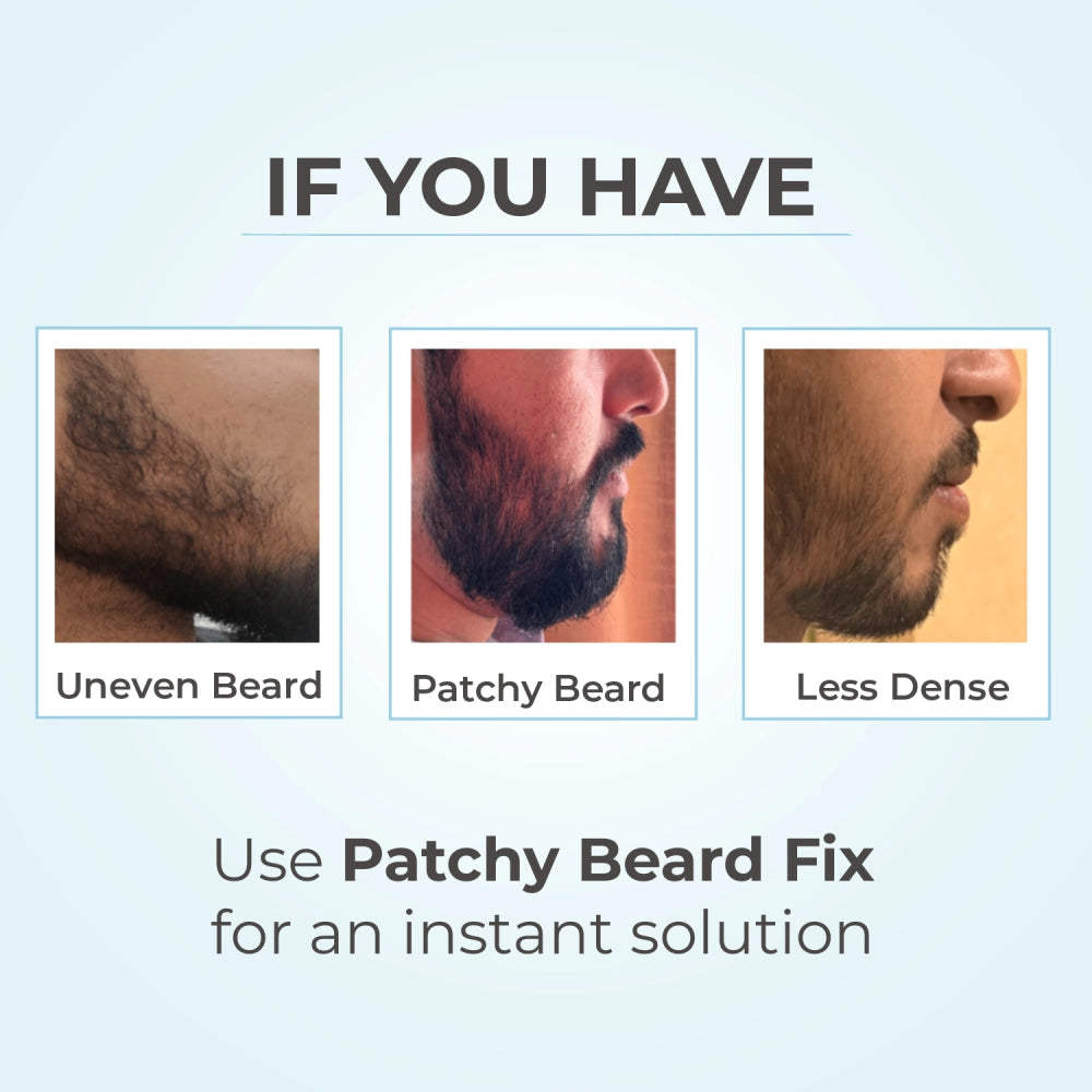 Patchy Beard Fix