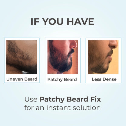 Patchy Beard Fix