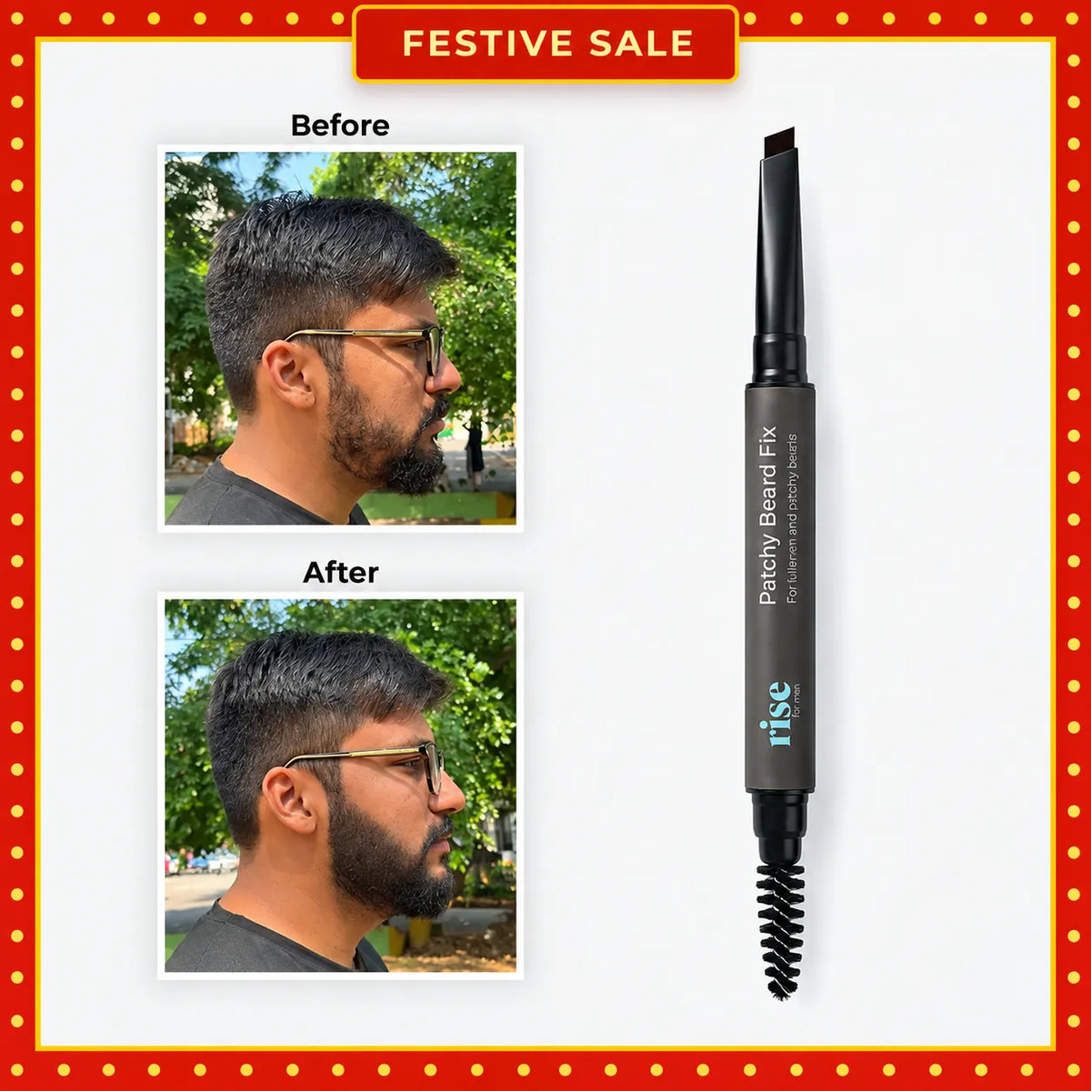 Patchy Beard Fix