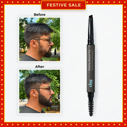 Patchy Beard Fix