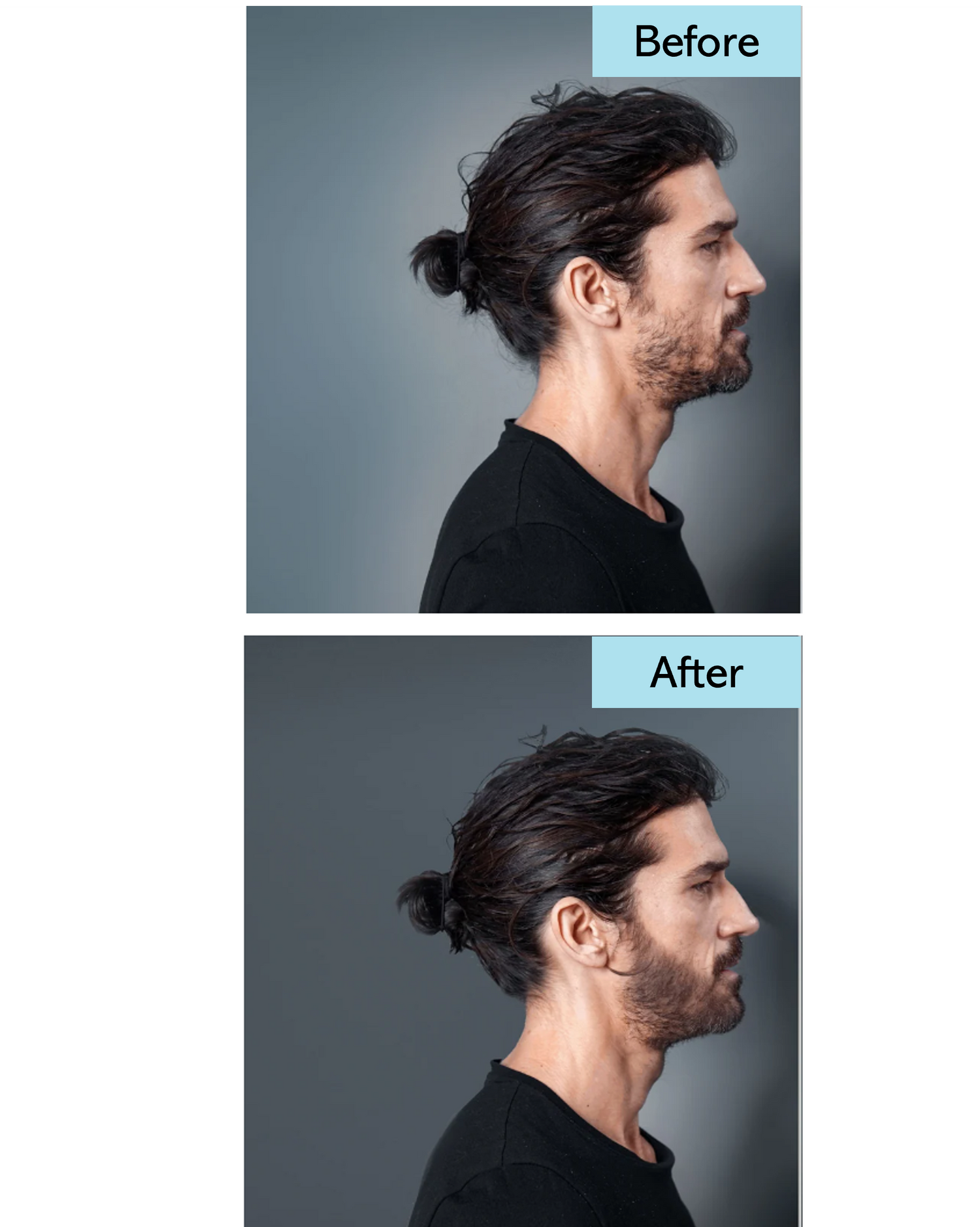 Patchy Beard Fix