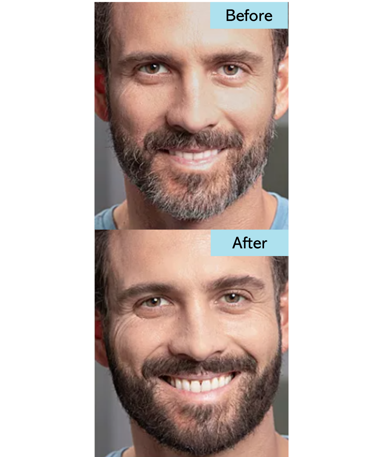 Instant Beard Fix