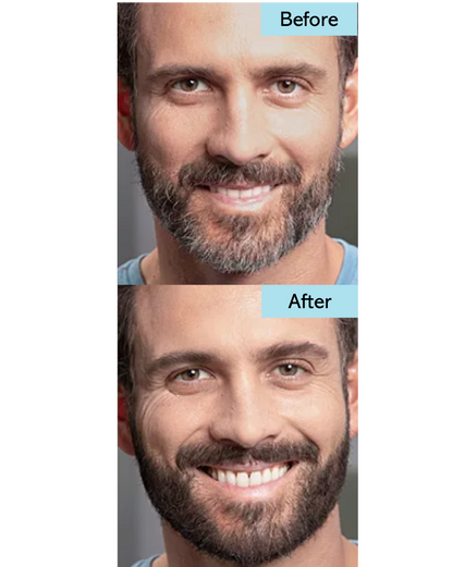 Instant Beard Fix