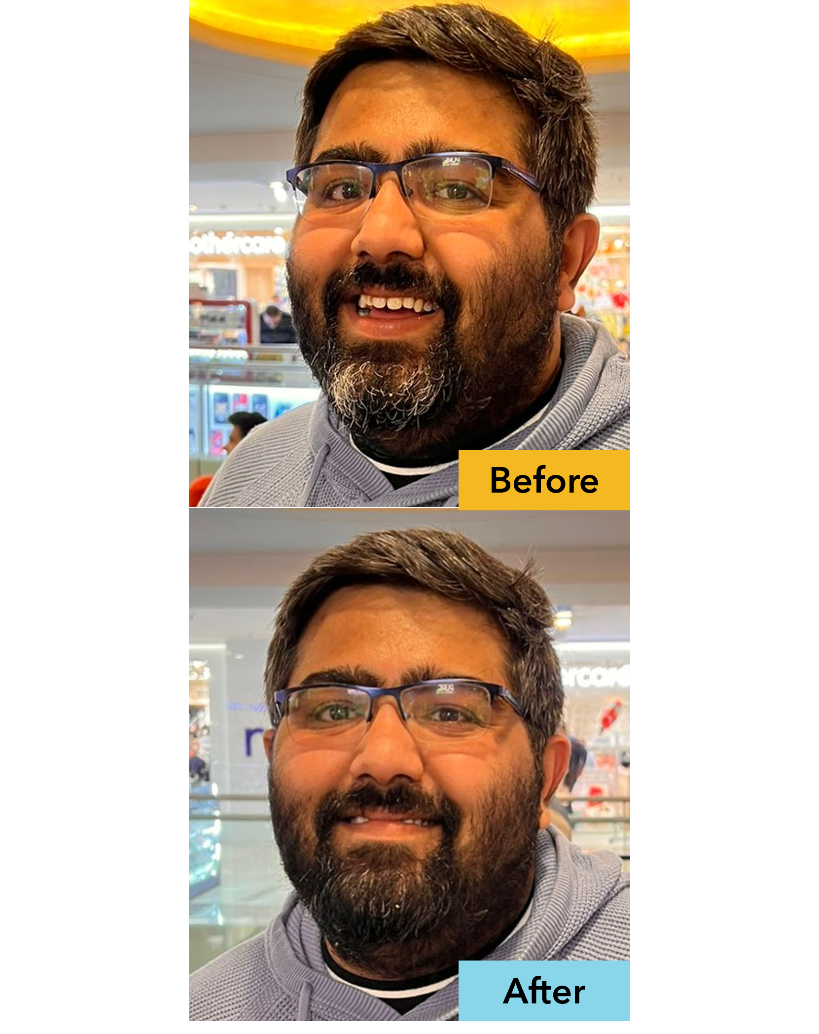 Instant Beard Fix